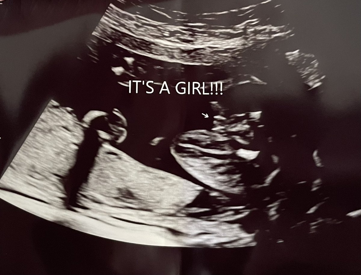 JevinIsDrunk's tweet photo. ITS A GIRL!!! https://t.co/i5Ci58IkUf