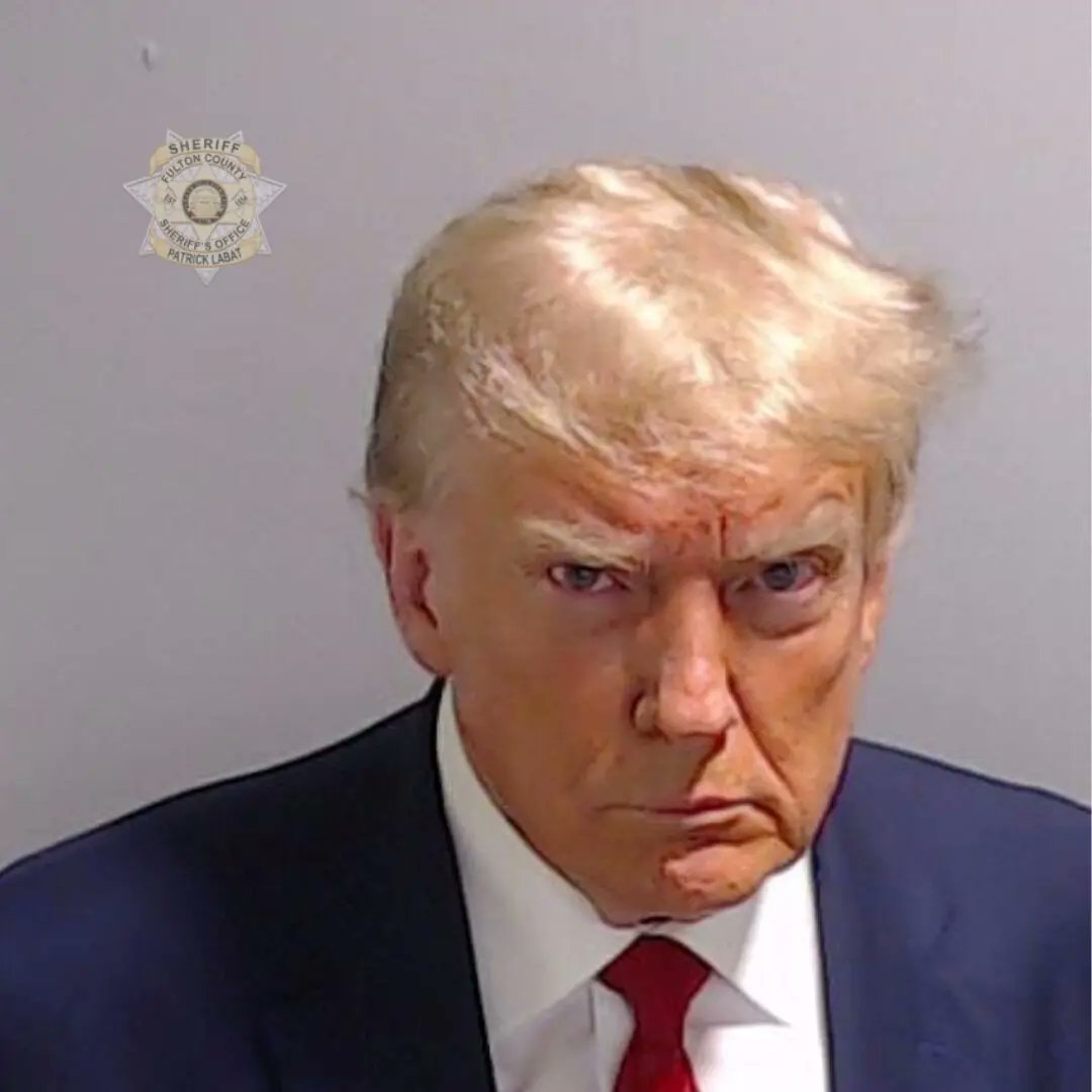 Does Trump look as if he has a black eye (his left eye)?