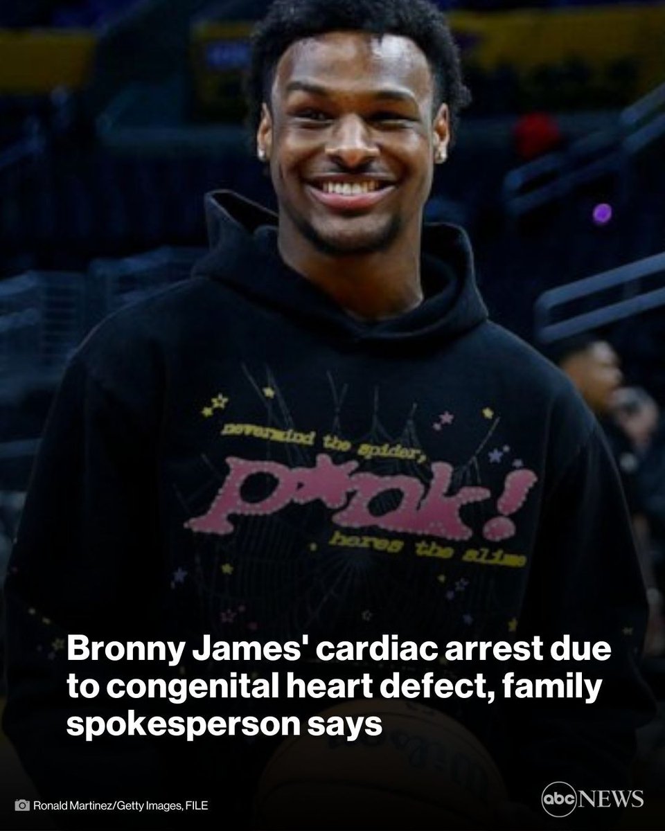 The probable cause of Bronny James' sudden cardiac arrest last month is a congenital heart defect and it will be treated, a family spokesperson says. trib.al/XSMDvDG