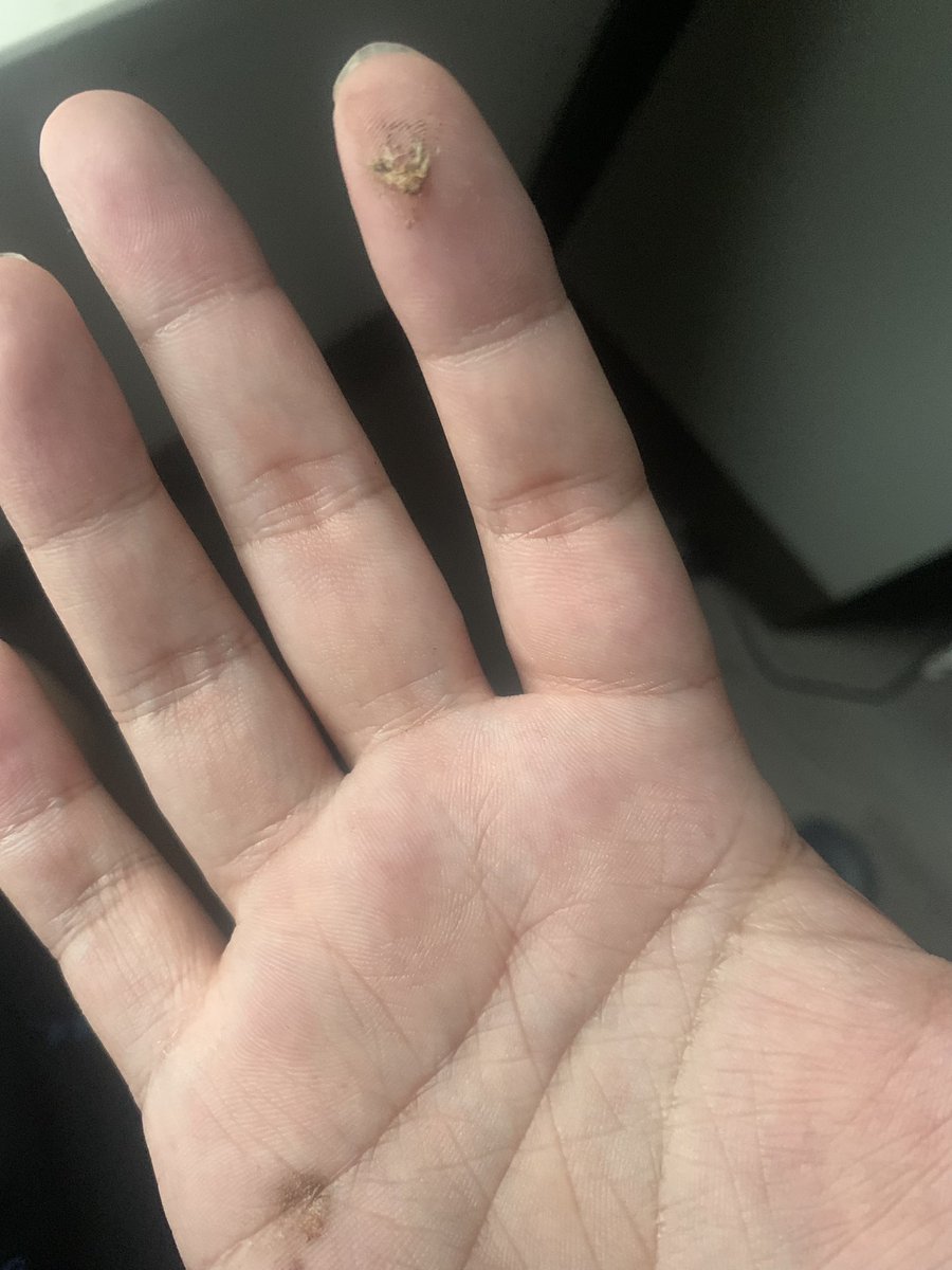 JamesCageWhite's tweet image. I killed a moth . God bless him