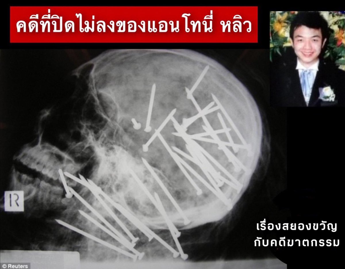 Kadeesayong's tweet photo. ปี 2008 ในตอนแรกมันก็คงจะเหมือนกับคดีฆ่าคนตายแล้วเอามาทิ้งทั่วไป แต่หลังจากที่ชันสูตรด้วยการ X-ray ก็ต้องตะลึงเมื่อพบว่าเขาถูกยิงที่ศีรษะและลำคอด้วยปืนยิงตะปูกว่า 34 ครั้ง ตะปูยาว 3 นิ้ว ไม่มีพยานหรือหลักฐานใดที่จะเชื่อมโยงไปหาคนร้ายทำให้การตายของเขายังคงเป็นปริศนาจนทุกวันนี้… https://t.co/NjDvS8AfX7