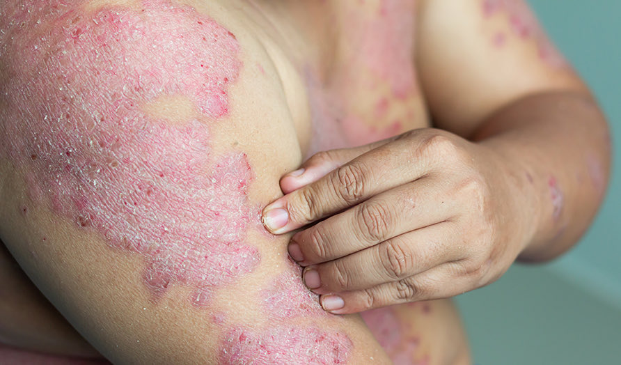 dermatology's tweet photo. Worsening rash with worsening joint pain - diagnosis? (source: JAAD) https://t.co/nGa2Mxsb00