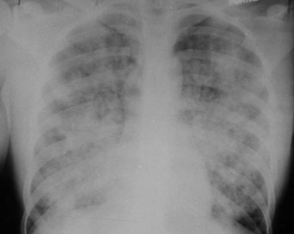 Make a diagnosis using these images 👍🏻

#MedTwitter