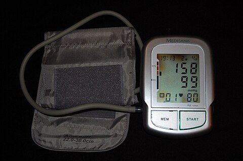 StrokeResearch2's tweet photo. The biggest risk factor for stroke is high blood pressure. Other risk factors include high blood cholesterol, tobacco smoking, obesity, diabetes mellitus, a previous TIA, end-stage kidney disease, and atrial fibrillation.
https://t.co/yBwh9ptUCK https://t.co/2XGhQhs0Po