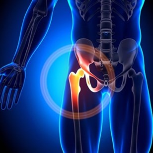 UniversalSurge1's tweet photo. A look at #hip #replacements in younger #adults 
Read more: https://t.co/hMhozcb4W9 
submit your paper on: https://t.co/7f9IQq9XFt 
#ipjus 
#manuscript 
#research  
#Hip #Surgery https://t.co/i51CulH10U