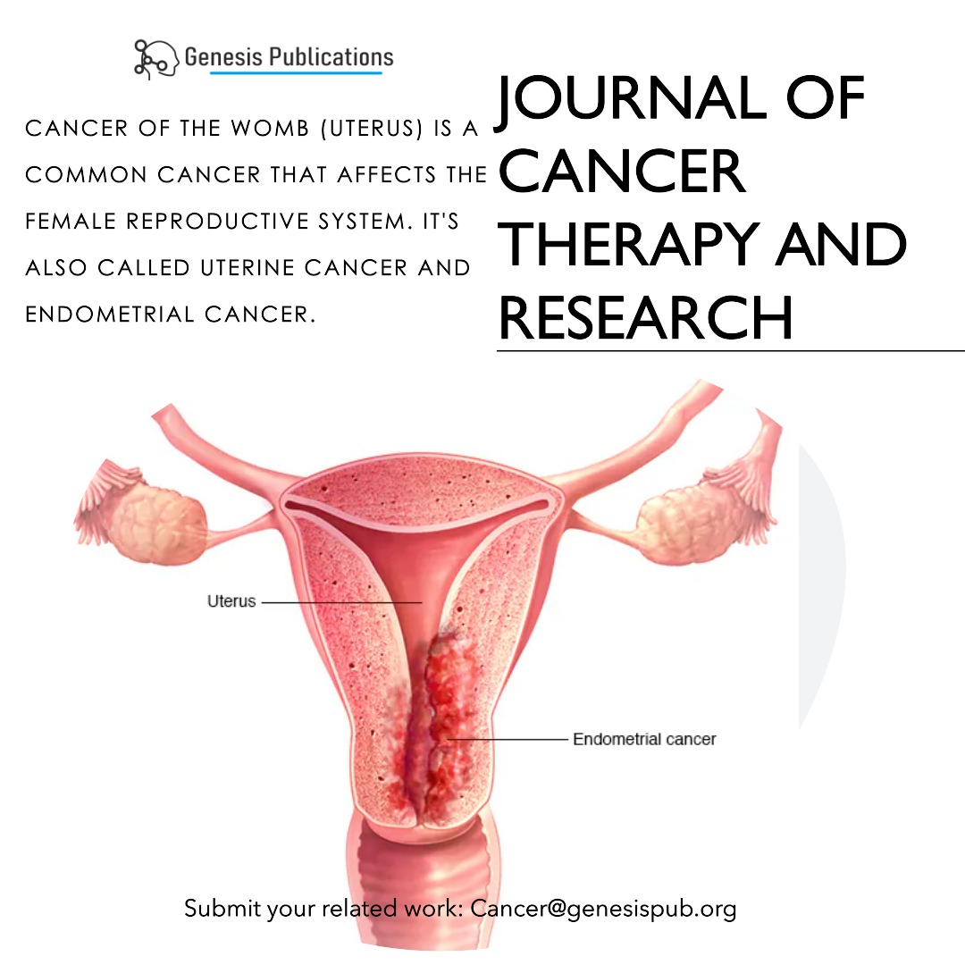 Journal of Cancer Therapy and Research Womb cancer is sometimes called uterine cancer by doctors as uterus is the medical name for the womb.

Submit your related work at: cancer@genesispub.org

#cancer #uterinecancer #wombcancer #oncology #chemotherapy #researcher #doctors