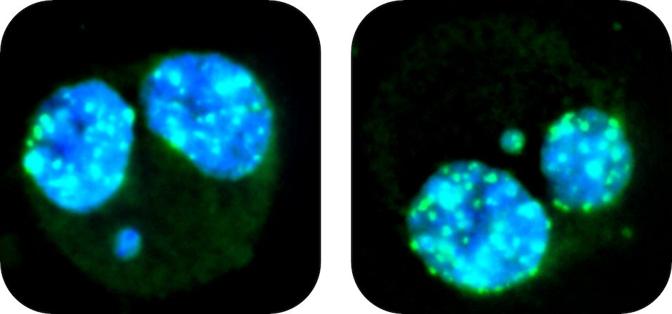 Xenometrix's tweet photo. Rapid Micronucleus MoA Discrimination between Aneugens and Clastogens within 1 hour !
Detection of bridges and NBUDs for chromosomal aberration or stability | Ready-to-use Kit | Fast and reliable | OECD TG487 and TG473
#micronucleus #aneugen #clastogen #chromosomal #TG487 #TG473 https://t.co/FyItDaVU7W