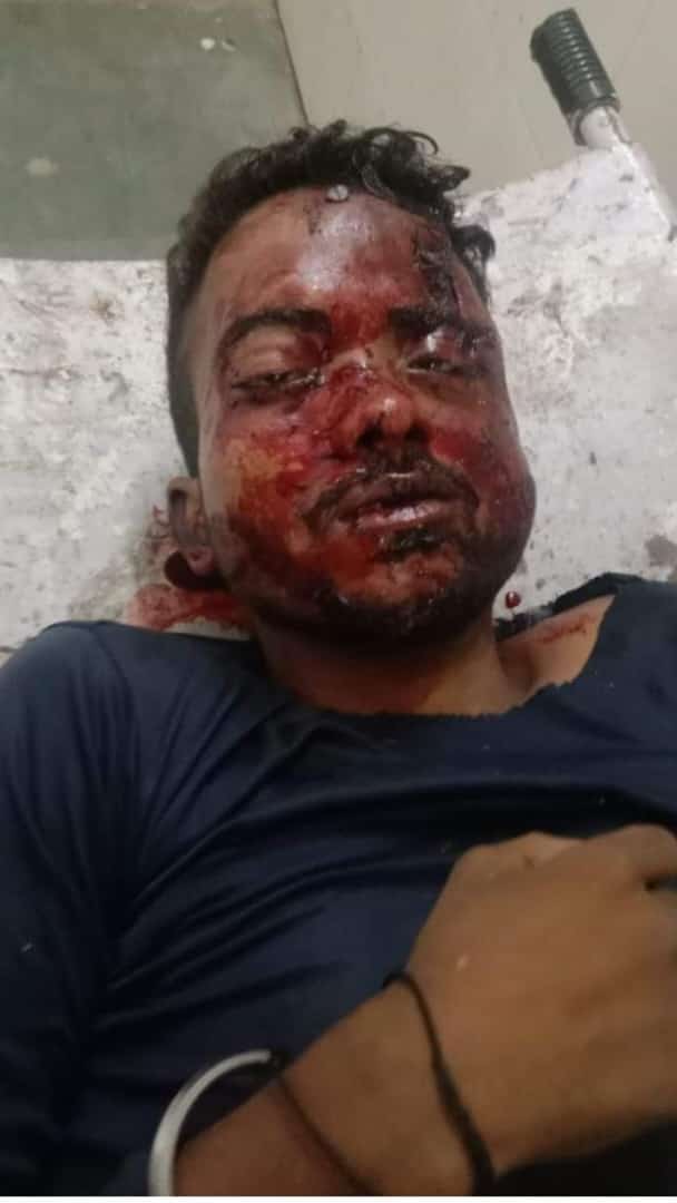 VimalBhimRaj5's tweet photo. @Uppolice @amethipolice @myogioffice महोना पश्चिम बाजार थाना सुक्ल बाजार जिला अमेठी में  विनय पासी सब्जी लेने गया था बाजार में कुछ निर्लज नीच किस्म के लोगों से विवाद हो गया जिसमे विनय पासी की मौके पर ही मौत हो गई है पुलिस प्रशासन मुकदमा पंजीकृत करके आरोपियों को तुरंत जेल भेजें। https://t.co/6qpbKsb5NX