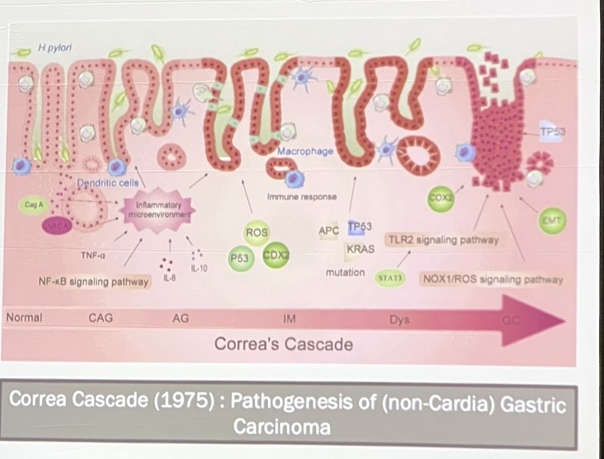 Mariam Naveed, MD (@mn_gimd) on Twitter photo I’ve been waiting for this one!
Making sense of Gastric Intestinal Metaplasia Guidelines <a href="/PrasadIyerMD/">Prasad G. Iyer, MD</a>
Why we care?
➡️ Precursor to gastric adeno
➡️5th cancer globally
⭐️Correa’s Cascade ⬇️
⭐️Cancer risk
➡️Extensive GIM RR2.0
➡️Incomplete GIM RR 3.3
#GITwitter I’ve been waiting for this one!
Making sense of Gastric Intestinal Metaplasia Guidelines <a href="/PrasadIyerMD/">Prasad G. Iyer, MD</a>
Why we care?
➡️ Precursor to gastric adeno
➡️5th cancer globally
⭐️Correa’s Cascade ⬇️
⭐️Cancer risk
➡️Extensive GIM RR2.0
➡️Incomplete GIM RR 3.3
#GITwitter