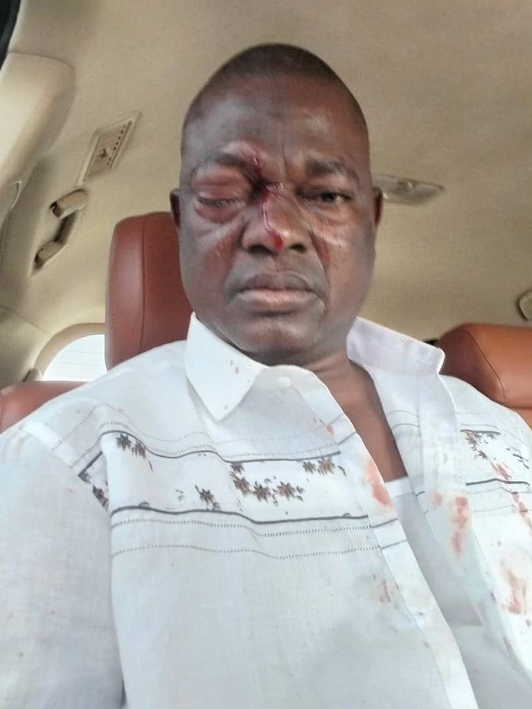 AnnanPerry's tweet image. Alan Kyerematen’s agent in the north east region beaten heavily.