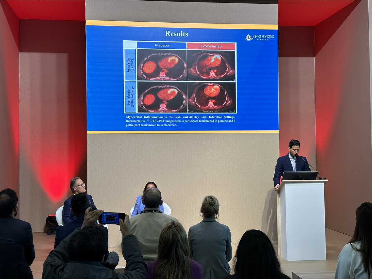 👉🏻Evolocumab reduces myocardial 🔥inflammation post 🫀ACS. Fantastic presentation by @TZiogos at #ESC2023 @hopkinsheart @rblument1 @DrMarthaGulati @AllisonGHaysMD @MichaelJBlaha @TarekHarbMD @ErinMichos