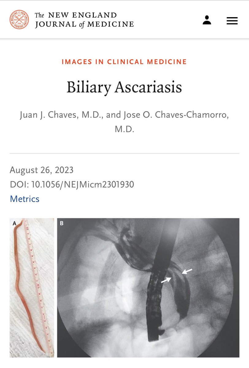 In med school, I proposed to a professor to write a letter to the NEJM. He said, "We are not doctors for those journals, let other people do it."

With my most fantastic mentor (my dad), we had a dream ...

An honor that a case from Colombia is published in the NEJM