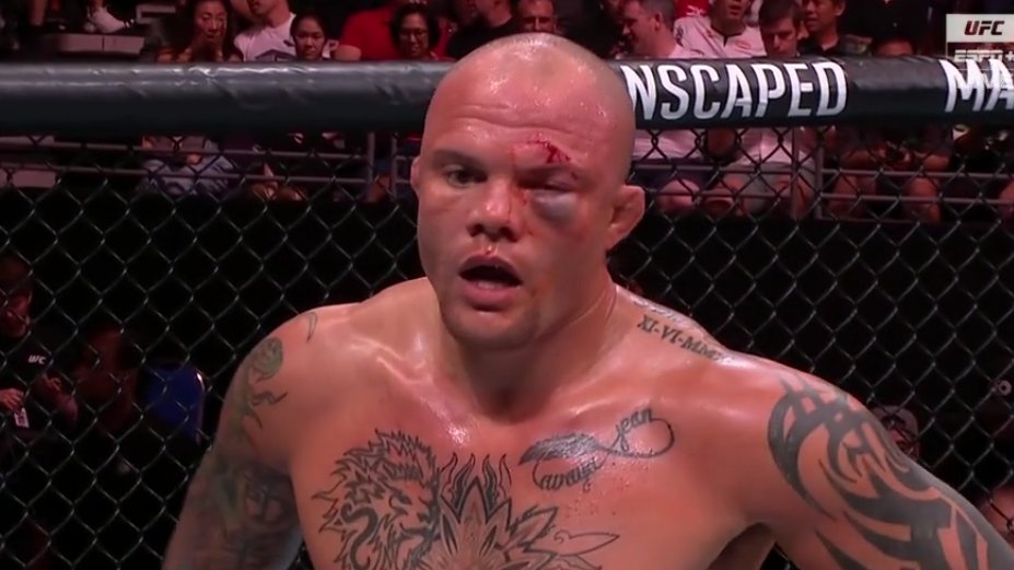 imstillshannon's tweet photo. #UFCSingapore https://t.co/EL6Xna7Hu8
