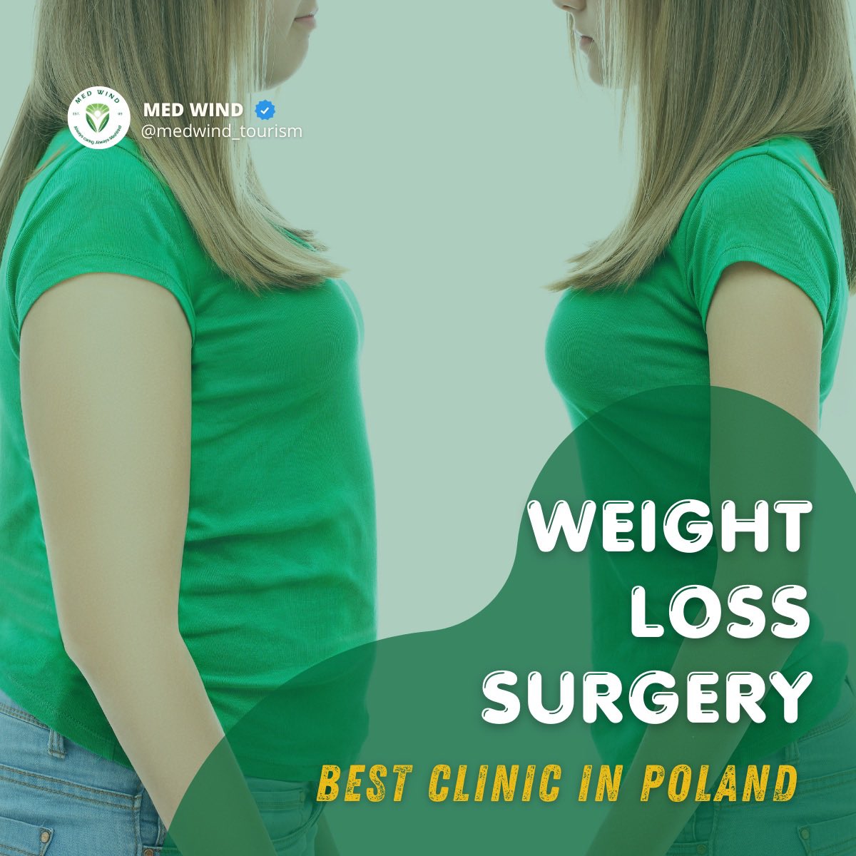 MedWind_'s tweet photo. Don't let obesity hold you back anymore! Take the first step towards a healthier, happier future by considering Gastric Sleeve Surgery at KCM Clinic in Poland.

✨ Contact us today to learn moreon

#GastricSleeveSurgery #KCMClinic #Poland #LifeChangingResults #HealthierYou https://t.co/rh3vsJmBtk