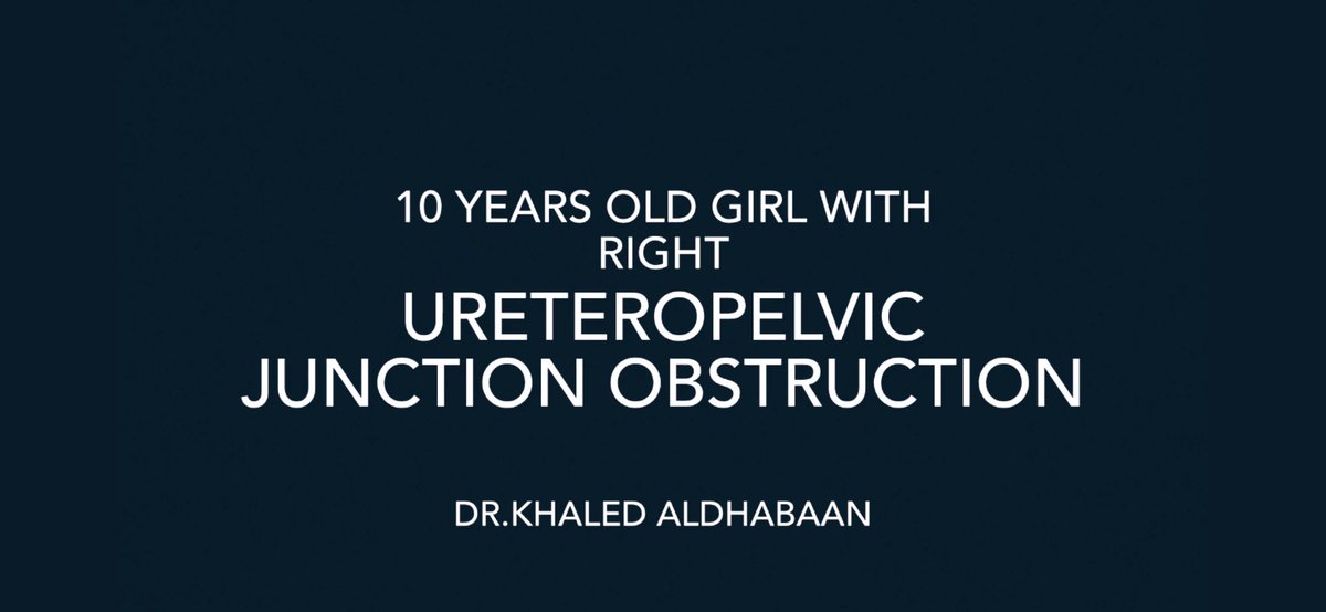 KAldhabaan's tweet photo. 10 ys girl with Dietl's crisis
Right #UPJO #aberrant
#lap #Pyeloplasty
#pediatricurology
#Peduro
#PedSurg
#laproscopic

Right laparoscopic pyeloplasty 
https://t.co/xctTQsd6bs https://t.co/gph7gsWTl1