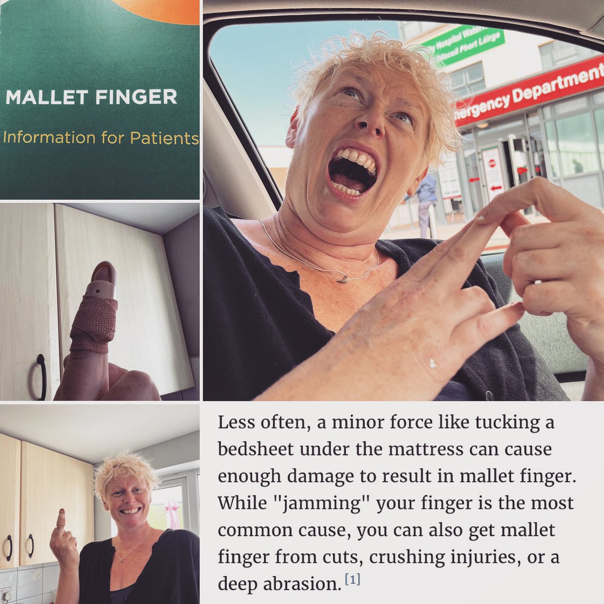 RedLedRoll's tweet photo. Nee Naw. @ellieobyrne1 has sustained an injury while changing bed linen on the bus. Our first bus related visit to A&E, and it was caused by a duvet rather than an angle grinder!? Mallet Finger. It’s a thing. Be careful out there #zerodayswithoutanaccident #airbnb #busconversion https://t.co/JKyPkCkkWL