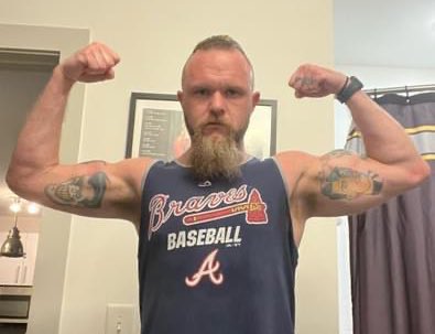 TheBoozerweight's tweet photo. Today vs July 25th. Slowly starting to get a peak back. #BionicBoozerweight https://t.co/2qgoF8P0Dy