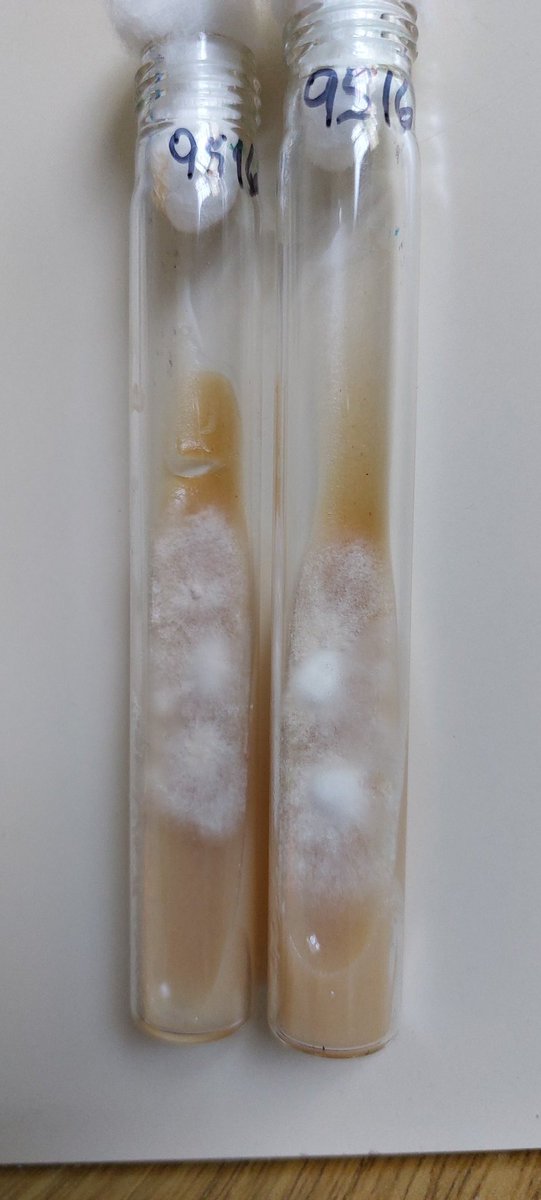 famessina's tweet photo. Trichophyton indotineae in Latín América, first case report.
Mycological examination is essential in all cases. #Trichophyton indotineae #resistent-terbinafine
#SUBA-itraconazole
#Trichophyton mentagrophytes complex
https://t.co/BwHqg3Ed3x https://t.co/o7RYJkvMZN