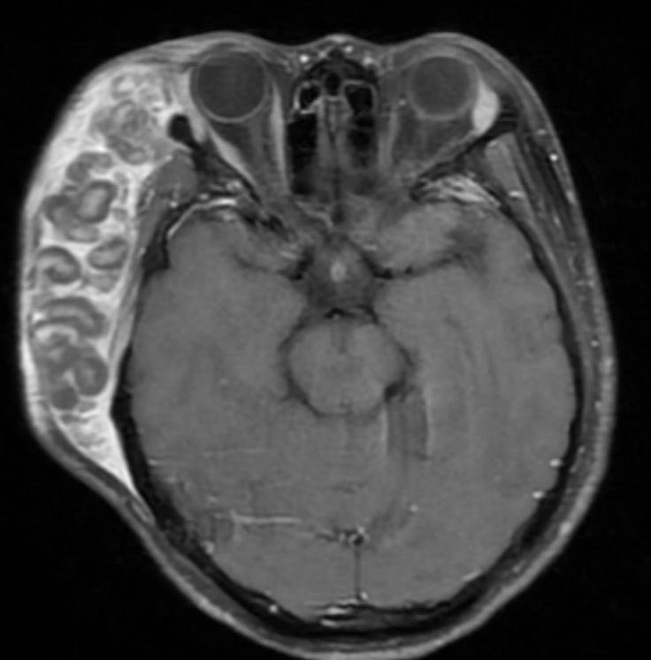 It’s not brain outside the brain, but any idea what it is? h/t ElShenawy