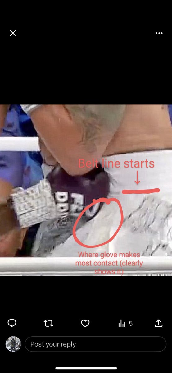 KungurcevT's tweet photo. @IFLTV @boxingontnt Guys… come on https://t.co/qfUbKFMvWK