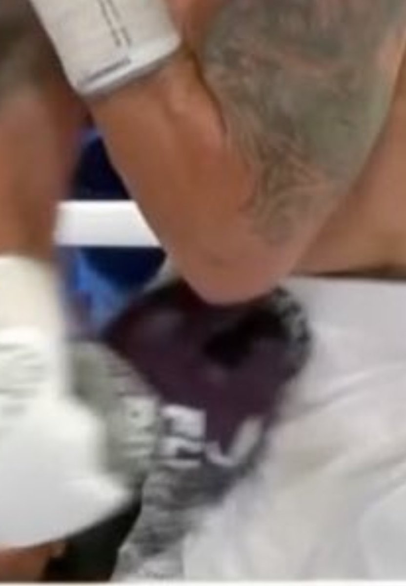 DreadPhil1's tweet photo. @leemulk @AlBernstein @Tyson_Fury The glove is making contact below the belt. Yes, the top of the glove is on the lower part of the belt but most of the glove is below and it’s an uppercut, meaning the contact started low and swept up https://t.co/nfKIVf7mOr