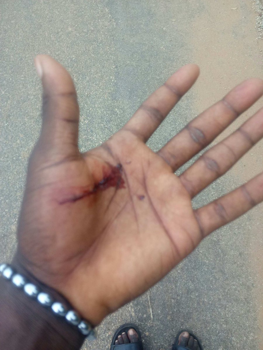 <a href="/BlessingGives/">Official Blessing</a> @dinnahh22 @Blessing_Give Uba danjuma Bashir acct number 2083508765 bless 🙏 me with anything to get drugs got an accident 😭 this evening ma I barely survived with enough bruise 😫 all over