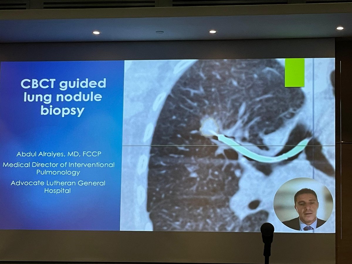 ArvinAlaga's tweet photo. Terrific presentation by @ahalraiyes on CBCT guided lung biopsy in MTS2023 https://t.co/CXteXVdrbd