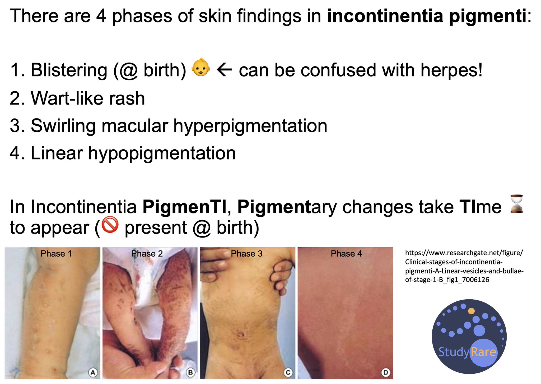 incontinentia-pigmenti-4-stages-bloch-sulzberger-syndrome-a-rare