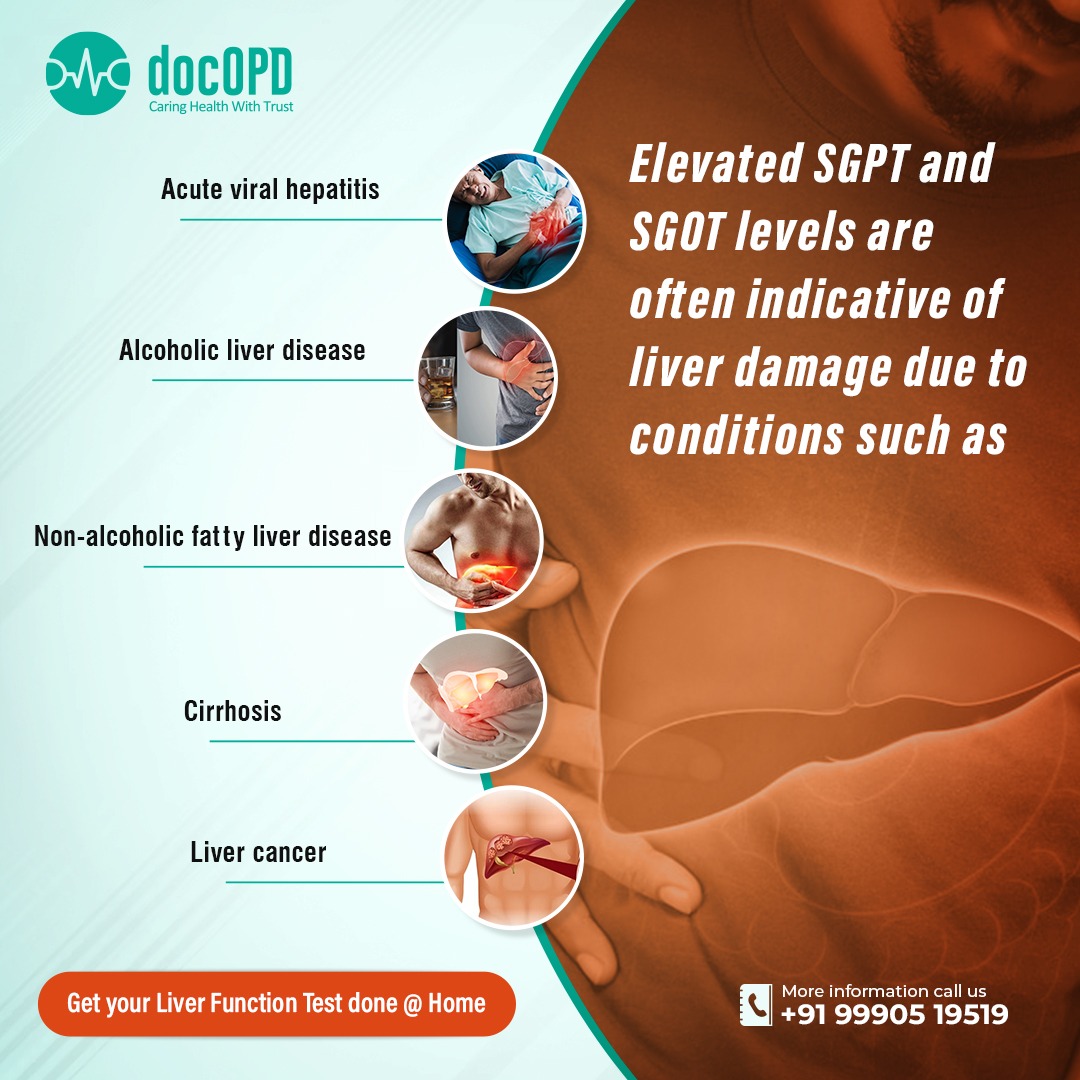 Elevated SGPT and SGOT levels are often indicative of liver damage due to conditions.
Get your Liver Function test Done @ home
#liverfunction #livertest #liverdamage #docOPD