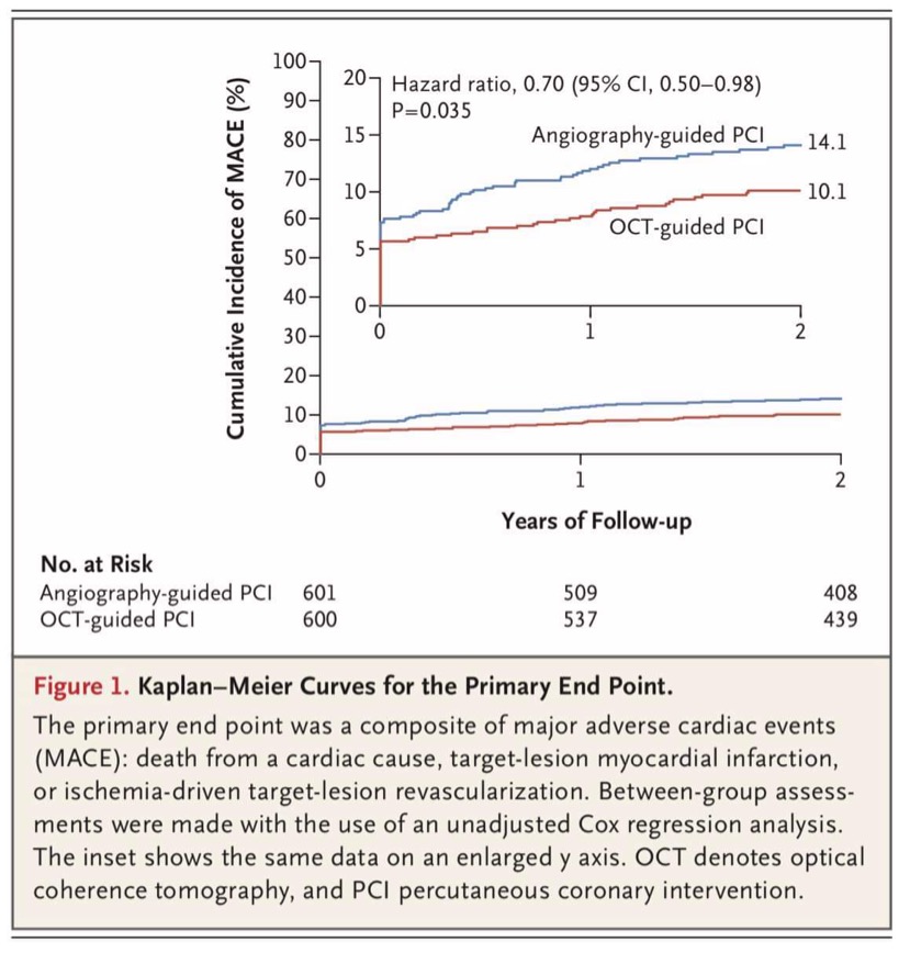 AUHCardio's tweet photo. Late-breaking Clinical Trial at #ESCCongress 

The @OctoberTrial presented by PhD Student @LNAndreasen showing superiority of OCT-guided PCI compared to Angiography Guidance on MACE!

Simultaneously published in @NEJM 

https://t.co/skGbTGGfSt https://t.co/dLEMSRGmuq