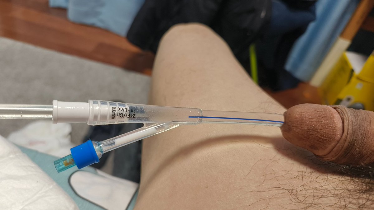 bobolp01's tweet photo. Silicon catheter for 2days!feel nice. https://t.co/LeKPv8jPmw