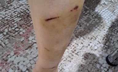 yirmiucderece's tweet image. İBB iştiraki Ağaç A.Ş'de çalışan Hacer Demirlendi, Miniatürk parkında temizlik yaparken İBB Başkan Danışmanı Murat Ongun'a ait olduğu öne sürülen Thor isimli köpeğin saldırısına uğradı.

Yaralanan Demirlendi, şeflerinin işten çıkartma tehditleri yüzünden sessiz kaldı ama