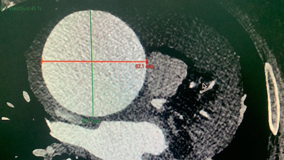 Dror Leviner tweet media