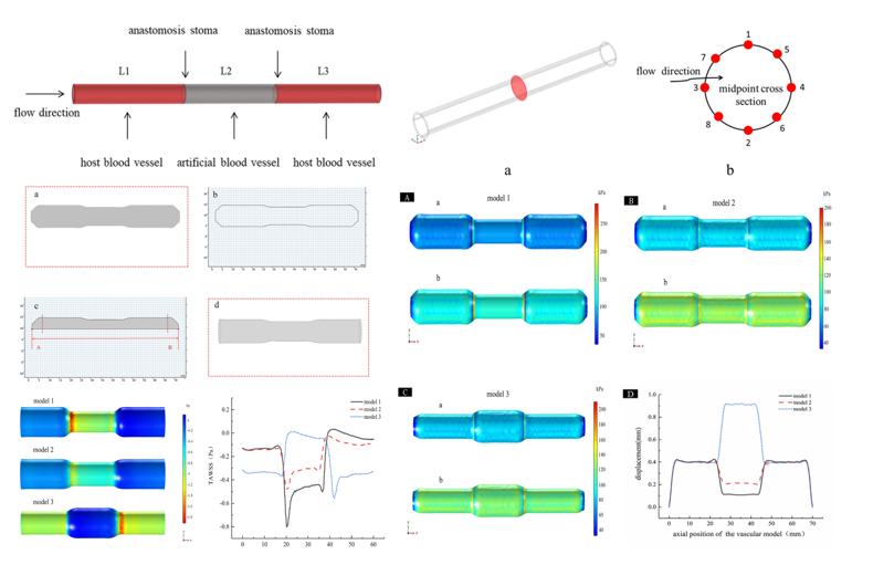 medntdj's tweet photo. Numerical simulation to study the impact of compliance mismatch between artificial and host blood vessel on hemodynamics
https://t.co/ZjWrnDErX3
#Numerical simulation #Artificial blood vessel #Compliance mismatch #Wall shear stress #Oscillatory shear index https://t.co/nKjpjVkl6P