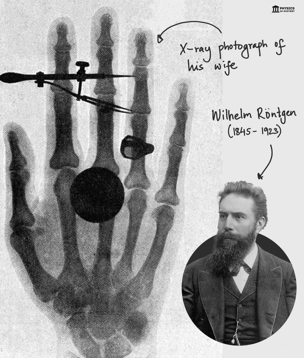 Wilhelm Röntgen and the accidental discovery of x-rays 💭 I was working ...