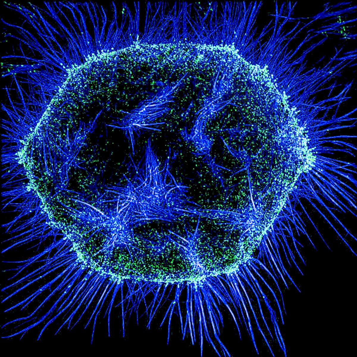 A cell in metaphase photographed through a microscope. Actin filaments (blue) and myosin II (green) are shown. #CellBiology