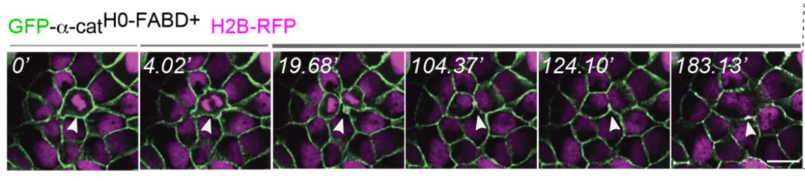xtalmountain's tweet photo. @GottardiLab Another compelling and beautiful preprint from @GottardiLab on the importance of α-catenin mechanosensitivity and LZTS2 in cytokinesis! Hopefully everyone will get to see the so-close-yet-fails-again cytokinesis movies soon😉 Congrats! https://t.co/fLCl4gcI2J