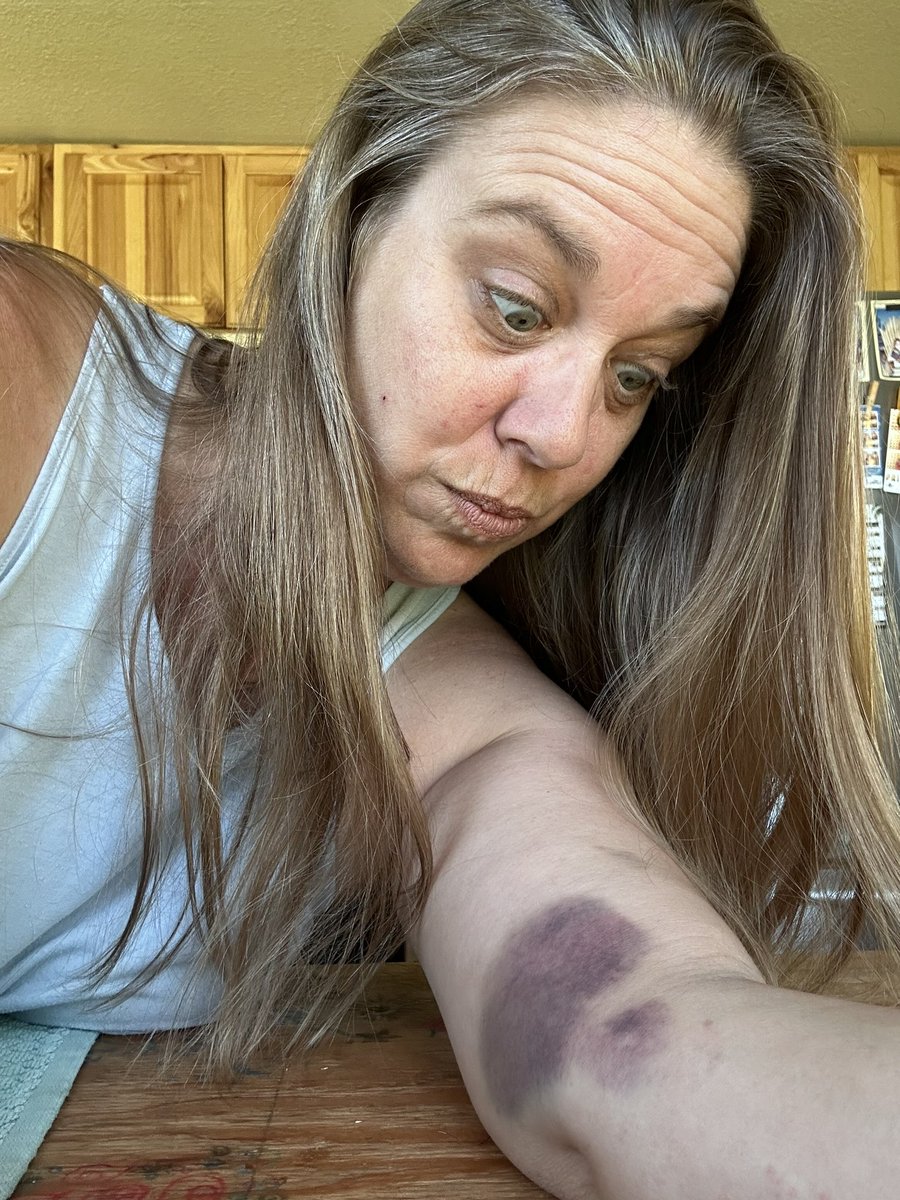 KatieGreksouk's tweet photo. You know it is a good one when you can see overnight progress. #GirlScouts #Archery #GSSD https://t.co/srTGzly3Qh