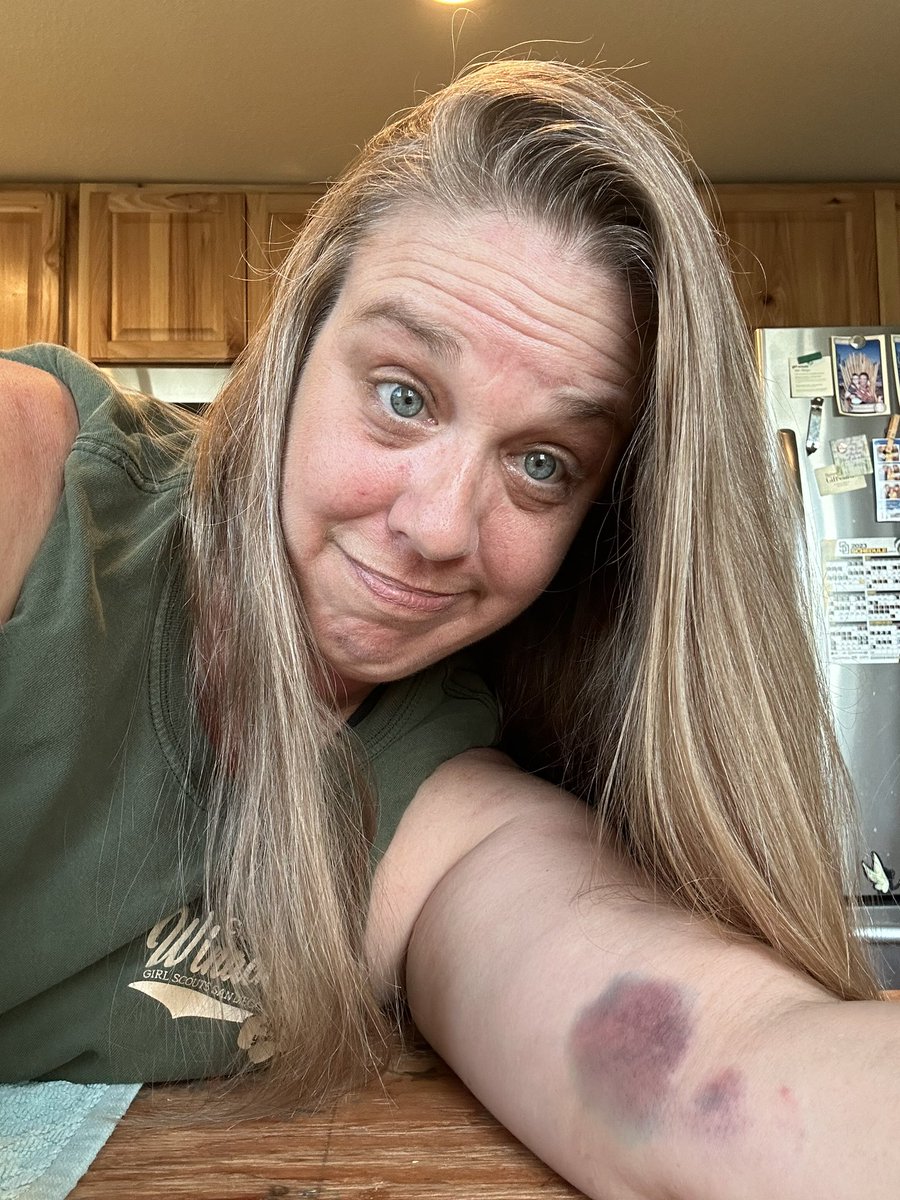 KatieGreksouk's tweet photo. You know it is a good one when you can see overnight progress. #GirlScouts #Archery #GSSD https://t.co/srTGzly3Qh