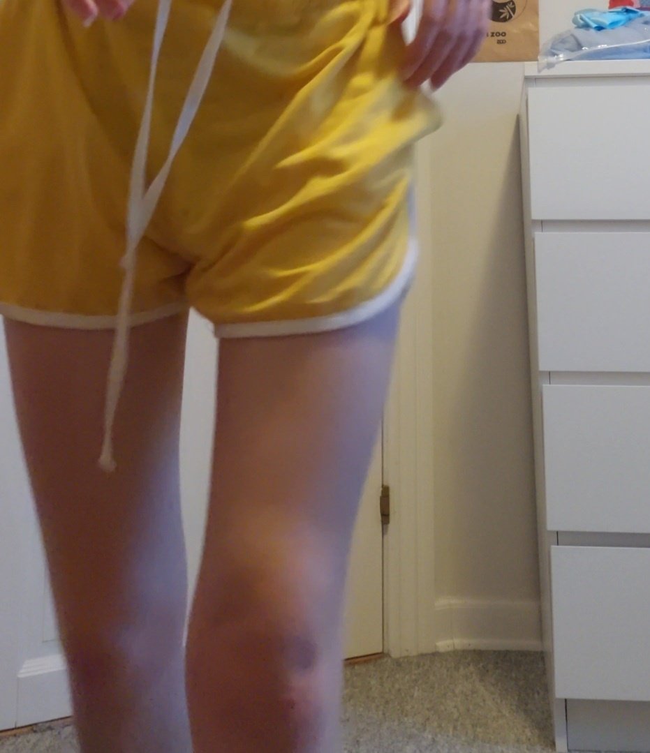 yeojspo's tweet photo. at long last,,, i have a thigh gap https://t.co/R7TO6WBC33