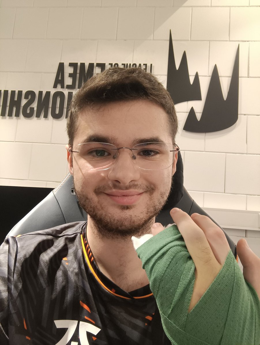 OscarininXD's tweet photo. Solo necesitaba una mano para gapear a Odo https://t.co/jV8APhfu5B