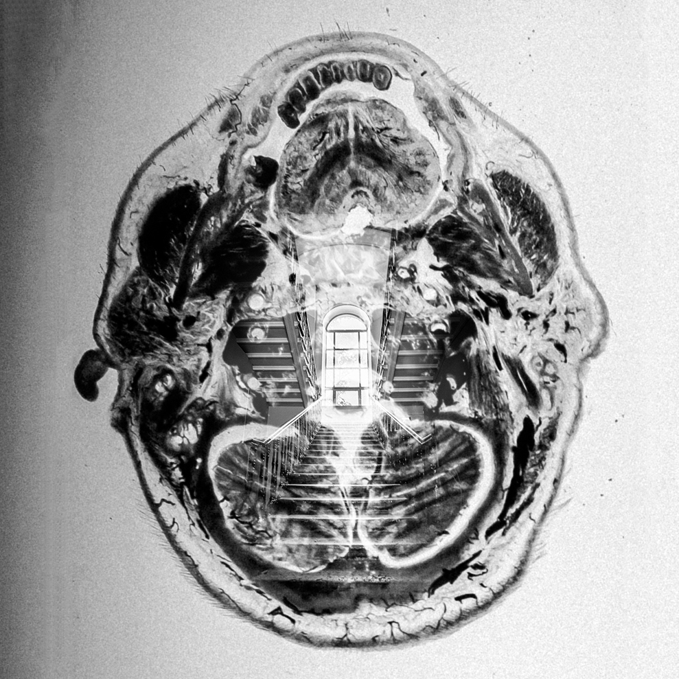 MIND SLICES 
continues the previous collection looking inside the human body. This time we're in the brain to SEE the mind.  objkt.com/collection/KT1…
50 editions of each slice and first 25 are just for 2 xtz!  
#nft #nftphotography #tezosart #tezos #objkt #tezoscollector #tezosnft