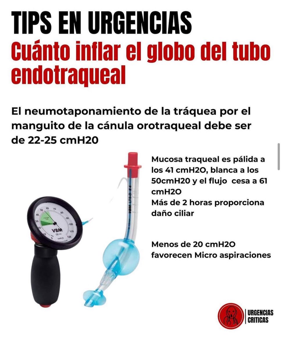 UrgCrit's tweet photo. Cuánto inflar el globo del tubo endotraqueal https://t.co/J2urdW7vGE