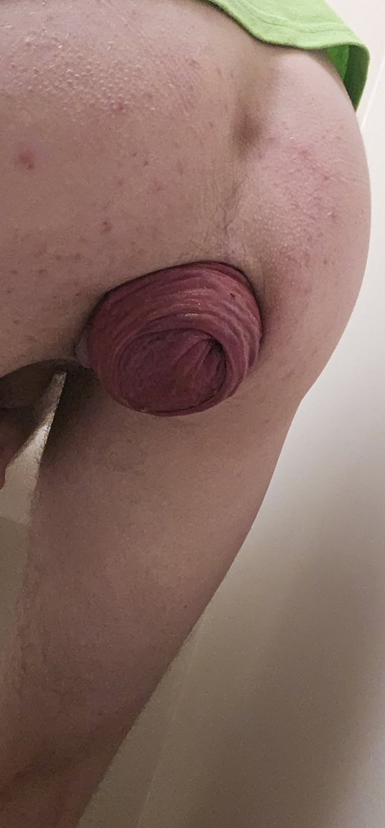 🔞 ff_hole_slut tweet media