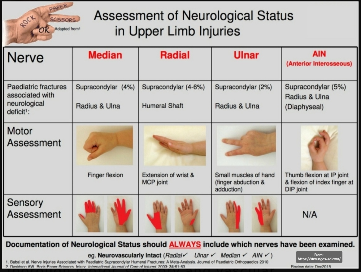 ✴️QUICK ASSESSMENT OF NEUROLOGICAL STATUS IN UPPER LIMB INJURIES:

🔴Using the ROCK, PAPER, SCISSORS, OK hand movements,the Radial,Median, Ulnar and Anterior intra-osseous nerves are assessed👍😊Children particularly enjoy the novelty of it!😄
Give it a try yourself!