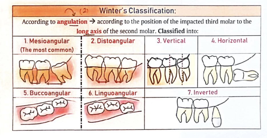 هديل 🕊 on X: "Winter's classification #Dental_by_Hadeel  https://t.co/WW3phVFs1E" / X