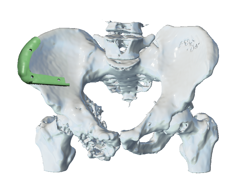 FabLab 3D Hospital Marañón tweet media