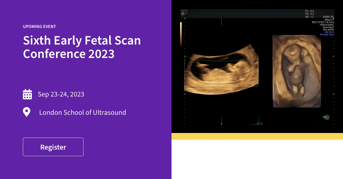 TheGrabner's tweet photo. Do not miss!
Register now, for the unique opportunity to join the Sixth Early Fetal Scan Conference 2023! Explore the latest developments in screening and enjoy the opportunity to discuss developments in the field with your peers: https://t.co/oOTHEnRZSx https://t.co/o9HaziuUmh