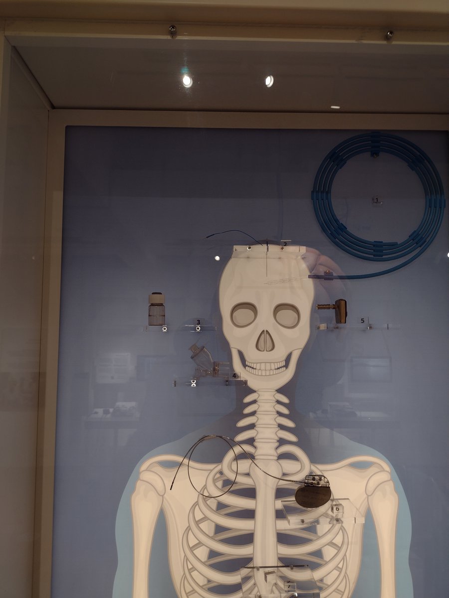 Do you want to get a glimpse of #Keratoprosthesis a novel artificial cornea 👁️ developed by <a href="/CURAMdevices/">CÚRAM</a> <a href="/AJL_Ophthalmic/">AJL Ophthalmic</a> and <a href="/CIDETEC_/">CIDETEC</a> within #TBMED ❓ 

Visit the exhibition #SUPERHUMAN at Galway City Museum!

➡️tbmed.eu/news/superhuma…