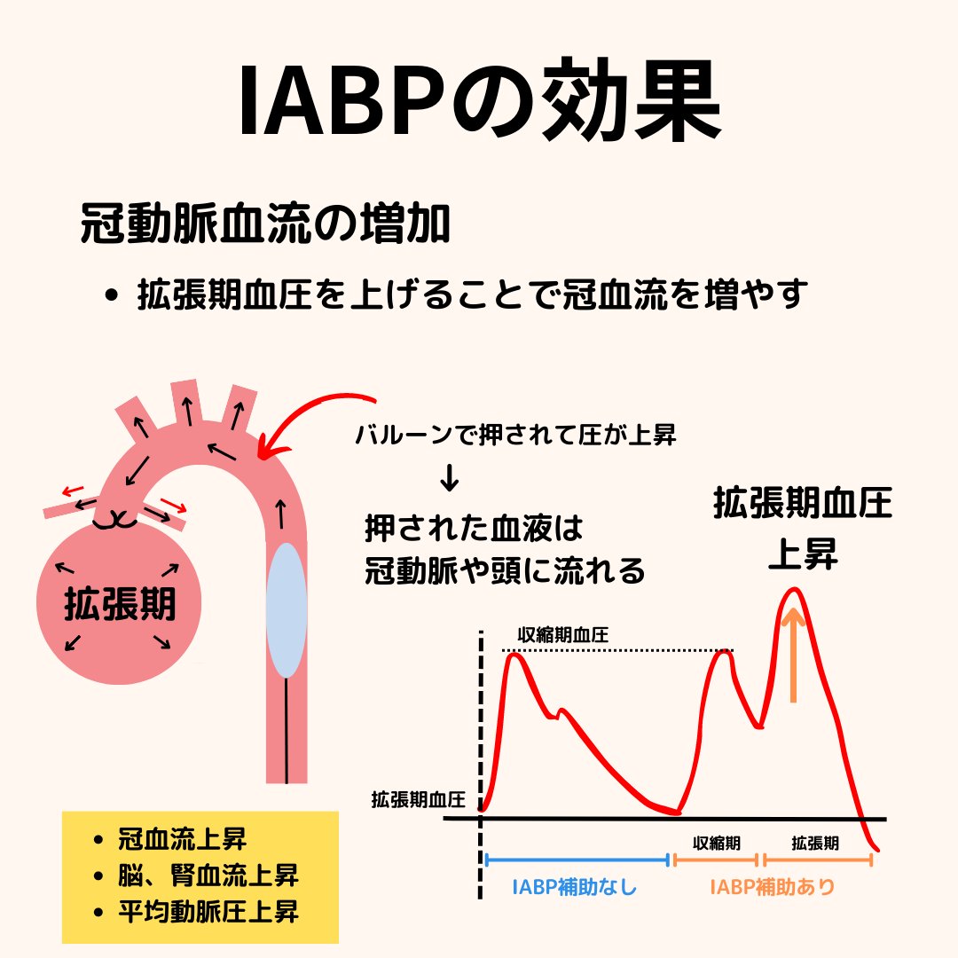 本日は【IABP】について 適応や禁忌を図解で解説。 ・なんでARが禁忌なの？ ・効果を簡単に知りたい？ って人は是非。  新人さんや勉強会の資料に役立てて頂けたらと思います。 参考になったらいいね、リポストお願いします🙇‍♂️ #臨床工学 #看護師 ＃集中治療 ＃補助循環